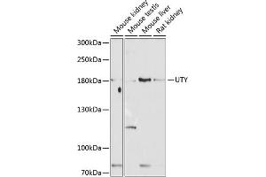 Western blot analysis of extracts of various cell lines, using UTY antibody (ABIN6132937, ABIN6150042, ABIN6150043 and ABIN6224660) at 1:1000 dilution. (UTY 抗体  (AA 1-70))