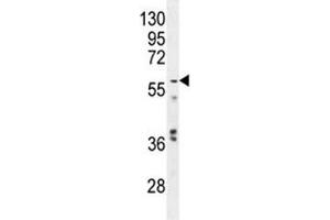 Western Blotting (WB) image for anti-Glypican 3 (GPC3) (AA 335-365) antibody (ABIN3031099)