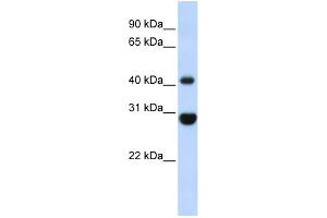 WB Suggested Anti-CNP Antibody Titration: 0. (Cnpase 抗体  (Middle Region))
