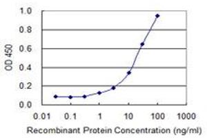 Detection limit for recombinant GST tagged SOX18 is 0. (SOX18 抗体  (AA 63-150))