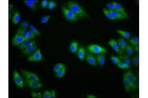 Immunofluorescence staining of HepG2 cells with ABIN7157546 at 1:133, counter-stained with DAPI. (KIRREL3 抗体  (AA 200-343))