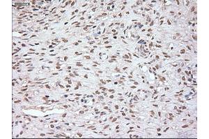 Immunohistochemistry (IHC) image for anti-Noggin (NOG) (AA 28-232) antibody (ABIN1491316) (NOG 抗体  (AA 28-232))