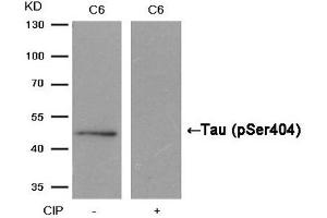 Western blot analysis of extracts from C6 cells, treated with calf intestinal phosphatase (CIP), using Tau (Phospho-Ser404) Antibody. (MAPT 抗体  (pSer404))