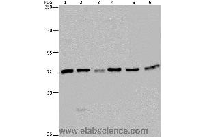 Western blot analysis of K562, A549, HT-29, 293T, Hela and Jurkat cell, using KARS Polyclonal Antibody at dilution of 1:350 (KARS 抗体)