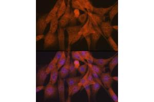 Immunofluorescence analysis of NIH-3T3 cells using K48-linkage Specific Ubiquitin Rabbit mAb (ABIN1680189, ABIN3017871, ABIN3017872 and ABIN7101530) at dilution of 1:100 (40x lens). (Ubiquitin B 抗体)