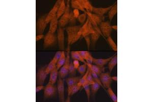 Immunofluorescence analysis of NIH-3T3 cells using K48-linkage Specific Ubiquitin Rabbit mAb (ABIN1680189, ABIN3017871, ABIN3017872 and ABIN7101530) at dilution of 1:100 (40x lens). (Ubiquitin B 抗体)