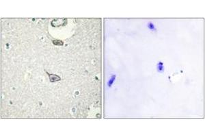 Immunohistochemistry analysis of paraffin-embedded human brain tissue, using CADM4 Antibody. (Cell Adhesion Molecule 4 抗体  (AA 339-388))