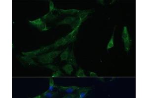 Immunofluorescence analysis of C6 cells using ARL3 Polyclonal Antibody at dilution of 1:100 (40x lens). (ARL3 抗体)