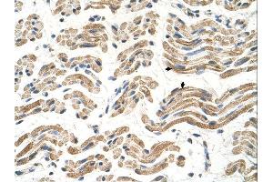 ALDH4A1 antibody was used for immunohistochemistry at a concentration of 4-8 ug/ml. (ALDH4A1 抗体  (C-Term))
