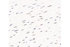 Immunohistochemistry analysis of paraffin-embedded rat heart using,PQBP1 (ABIN7075126) at dilution of 1: 6000