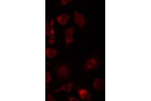 ABIN6267434 staining 293 by IF/ICC. (Synaptotagmin 抗体  (pSer309))