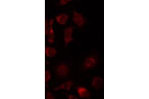 ABIN6267434 staining 293 by IF/ICC. (Synaptotagmin 抗体  (pSer309))