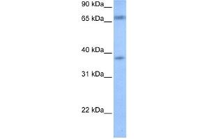 WB Suggested Anti-FEM1B Antibody Titration: 0. (FEM1B 抗体  (Middle Region))