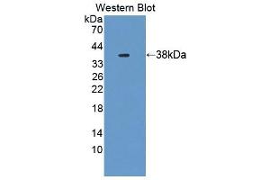 Western blot analysis of the recombinant protein. (UBAP1 抗体  (AA 1-295))