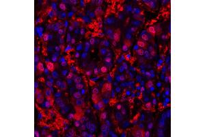 Immunofluorescence (IF) image for anti-Arginase, Liver (ARG1) (AA 1-322) antibody (ABIN7454020)