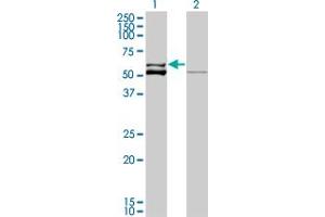 Western Blot analysis of GLUD2 expression in transfected 293T cell line by GLUD2 monoclonal antibody (M01A), clone 3C2. (GLUD2 抗体  (AA 1-264))