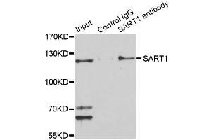 Immunoprecipitation analysis of 150ug extracts of Jurkat cells using 3ug SART1 antibody.