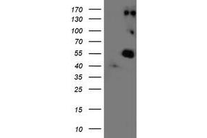 Western Blotting (WB) image for anti-Lysyl Oxidase (LOX) (AA 22-168) antibody (ABIN1491215) (LOX 抗体  (AA 22-168))