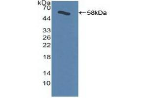 Western blot analysis of recombinant Human ADRbK1. (GRK2 抗体  (AA 398-640))