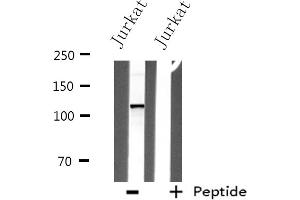 Western blot analysis of extracts from Jurkat cells, using ITPKB antibody.