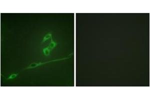 Immunofluorescence analysis of NIH-3T3 cells, using p70 S6 Kinase (Ab-371) Antibody. (RPS6KB1 抗体  (AA 337-386))