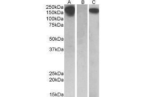 HEK293 lysate (10ug protein in RIPA buffer) overexpressing Human CSF1R with C-terminal MYC tag probed with ABIN2562031 (0. (CSF1R 抗体  (AA 700-710))