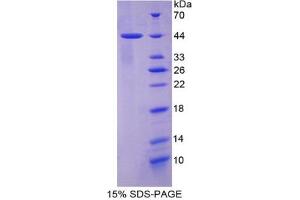SDS-PAGE of Protein Standard from the Kit (Highly purified E. (Cytokeratin 7 ELISA 试剂盒)