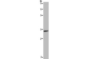 Gel: 8 % SDS-PAGE, Lysate: 40 μg, Lane: Human testis tissue, Primary antibody: ABIN7129748(HSD17B7 Antibody) at dilution 1/200, Secondary antibody: Goat anti rabbit IgG at 1/8000 dilution, Exposure time: 10 minutes (HSD17B7 抗体)