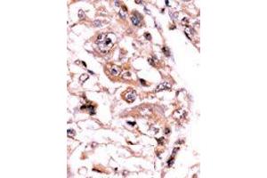 Image no. 2 for anti-Protein Phosphatase 3, Catalytic Subunit, gamma Isozyme (PPP3CC) (AA 480-509), (C-Term) antibody (ABIN360813) (PPP3CC 抗体  (C-Term))