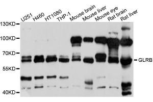 Western blot analysis of extracts of various cells, using GLRB antibody. (GLRB 抗体)