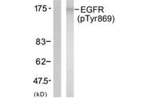 Western Blotting (WB) image for anti-Epidermal Growth Factor Receptor (EGFR) (pTyr869) antibody (ABIN2888401) (EGFR 抗体  (pTyr869))