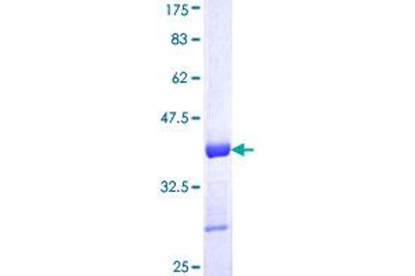 XRCC1 Protein (AA 534-633) (GST tag)