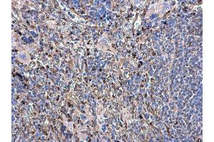 IHC-P Image beta Tubulin antibody detects beta Tubulin protein at cytoplasm in rat spleen by immunohistochemical analysis. (TUBB 抗体)