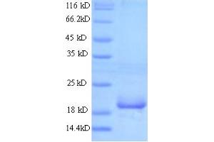 SDS-PAGE (SDS) image for BETAT (AA 16-198) protein (His tag) (ABIN5714436) (BETAT (AA 16-198) protein (His tag))
