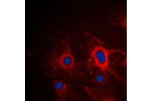 Immunofluorescent analysis of iNOS staining in A549 cells. (NOS2 抗体  (C-Term))