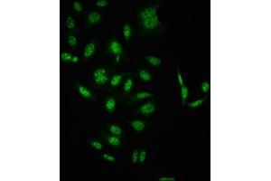 Immunofluorescence staining of HepG2 cells(treated with 50 mM Calyculin A for 30 min) with ABIN7127739 at 1:100,counter-stained with DAPI. (Recombinant RAF1 抗体  (pSer621))