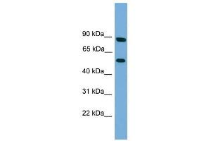 RFTN2 antibody used at 1 ug/ml to detect target protein. (RFTN2 抗体  (N-Term))