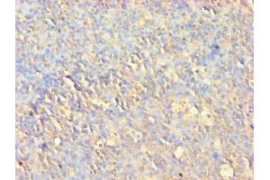 Immunohistochemistry (IHC) image for anti-V-Akt Murine Thymoma Viral Oncogene Homolog 1 (AKT1) (AA 1-480) antibody (ABIN7167024)