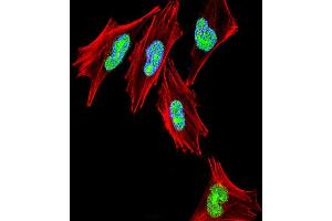 Fluorescent confocal image of  cell stained with TBX1 Antibody (C-term) (ABIN653331 and ABIN2842819). (T-Box 1 抗体  (C-Term))