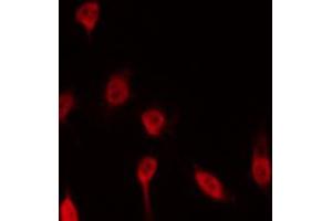 ABIN6267465 staining HeLa by IF/ICC.