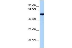 WB Suggested Anti-Oxsr1 Antibody   Titration: 1. (OXSR1 抗体  (Middle Region))