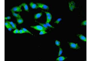 Immunofluorescence (IF) image for anti-Tubulin Folding Cofactor B (TBCB) (AA 1-244) antibody (ABIN7173734)