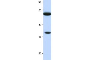 Host:  Rabbit  Target Name:  HRG  Sample Type:  Human Liver  Antibody Dilution:  1. (HRG 抗体  (Middle Region))