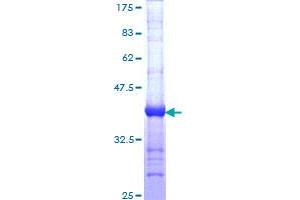 Dystonin Protein (DST) (AA 401-500) (GST tag)