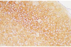 Immunohistochemistry of paraffin-embedded Mouse brain using TGFBR1 Polycloanl Antibody at dilution of 1:200 (TGFBR1 抗体)