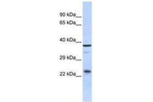 Image no. 1 for anti-SERTA Domain Containing 1 (SERTAD1) (AA 35-84) antibody (ABIN6742458) (SERTAD1 抗体  (AA 35-84))