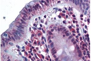 Human Colon (formalin-fixed, paraffin-embedded) stained with CD180 antibody ABIN343899 at 5 ug/ml followed by biotinylated goat anti-rabbit IgG secondary antibody ABIN481713, alkaline phosphatase-streptavidin and chromogen. (CD180 抗体  (N-Term))