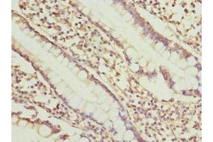 Immunohistochemistry of paraffin-embedded human small intestine tissue using ABIN7149657 at dilution of 1:100 (SGCD 抗体  (AA 60-289))