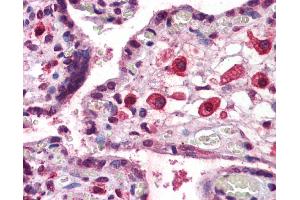 Immunohistochemistry (IHC) image for anti-Eomesodermin (EOMES) (C-Term) antibody (ABIN2779928) (EOMES 抗体  (C-Term))