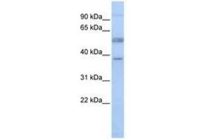 Image no. 1 for anti-Lymphocyte-Specific Protein 1 (LSP1) (AA 36-85) antibody (ABIN6741485) (LSP1 抗体  (AA 36-85))